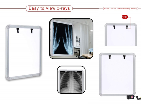 X Ray LED View Box (Single & Double)